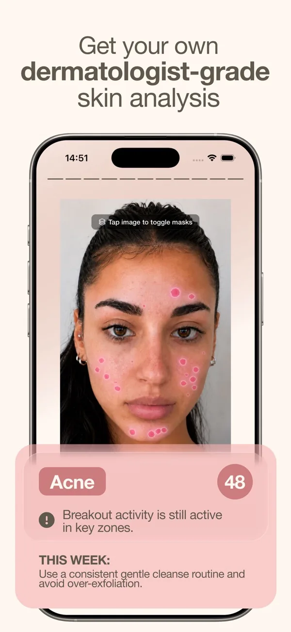 Skan app skin analysis marking spots on a face, with an acne score of 48.