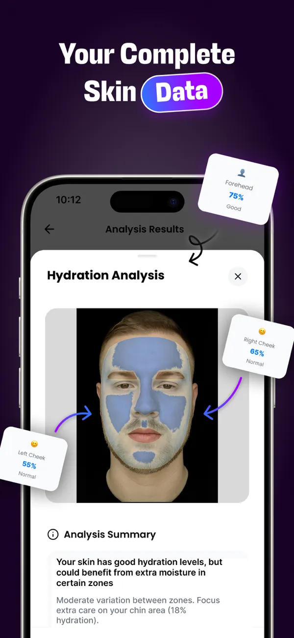 SkinPal AI hydration analysis showing a face with a colored map and a score for each zone.